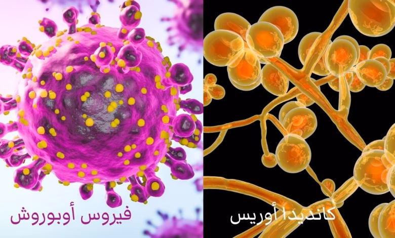 العالم في مواجهة تحديين وبائيين: أوروبوش وكانديدا أوريس وخريطة ما بعد كوفيد 17 Oropouche and auris